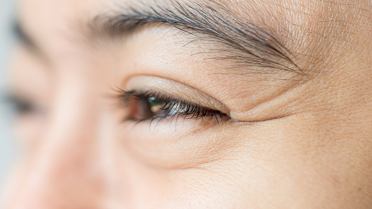 a closeup of a young Asian woman's eyes with crows feet as she smiles